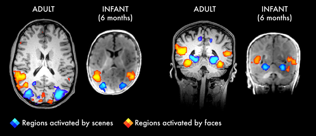 Adult and Child Brain Scans