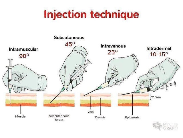 Injection Types