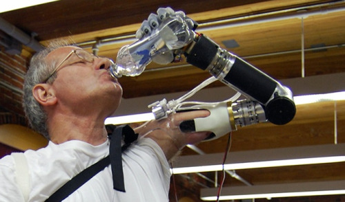 Bionic Arm Prosthetic